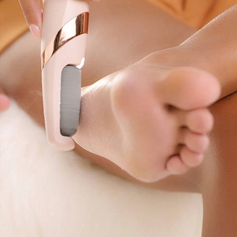 Lixador de Pé Elétrico - Esfoliador Tira Calos Pedicure Portátil Marisa Lixa Elimina Calo Usb